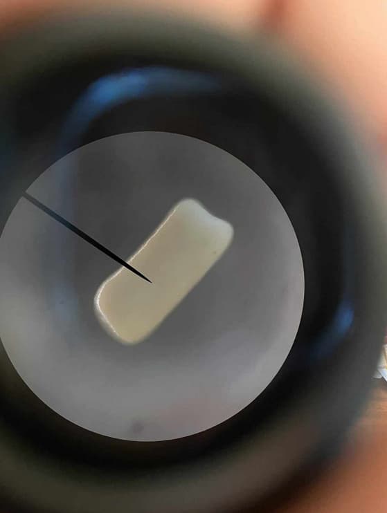 Yeast as viewed from a microscope