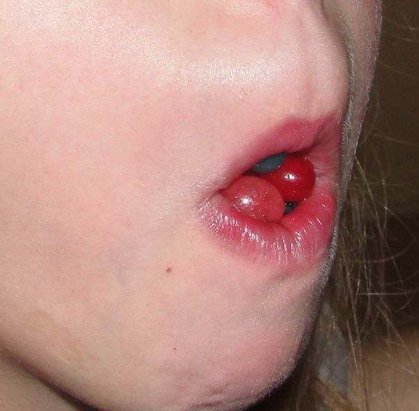 Imitating mouth brooder fish using jellybean "eggs" 