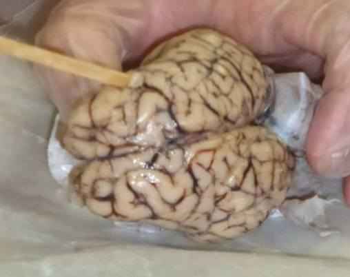 Inspecting the brain before making any cuts