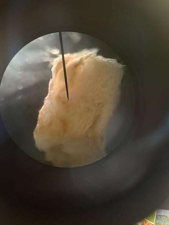 Mold from a strawberry as viewed from a microscope