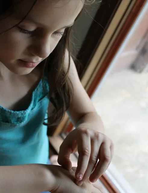 Shedding "skin" (dried Elmer's glue) like a reptile
