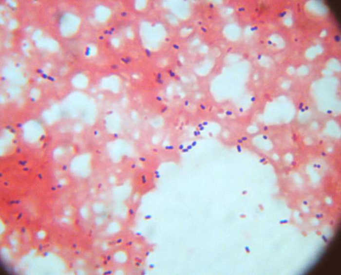 Image credit: http://biology.clc.uc.edu/fankhauser/Labs/Microbiology/Gram_Stain/Gram_stain_images/index_gram_stain_images.html