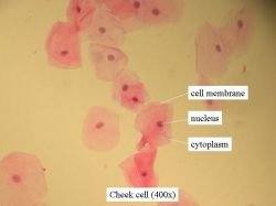 Cheek cells under a microscope magnified 400x