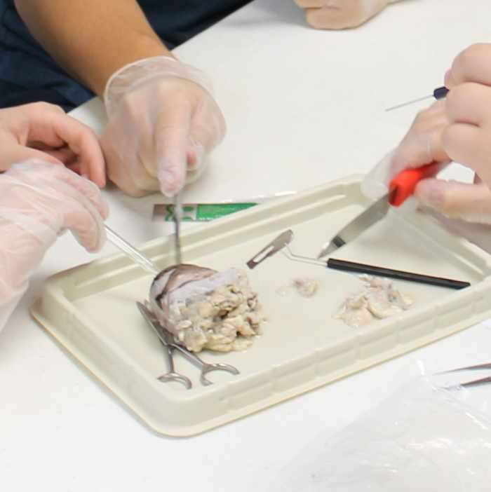 Dissecting a cow eyeball