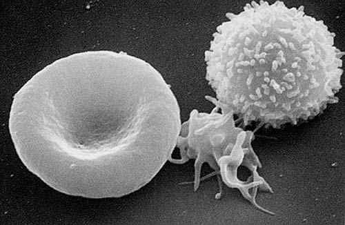 Red blood cell (erythrocyte), platelet, and white blood cell (leukocyte)