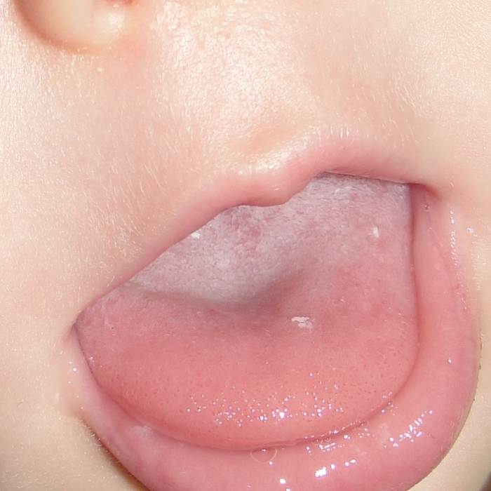 Comparing our tongues to amphibian tongues